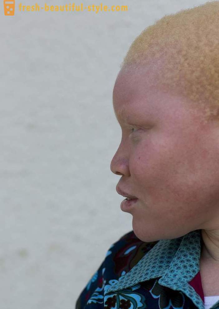Трагична историја Танзаније албино