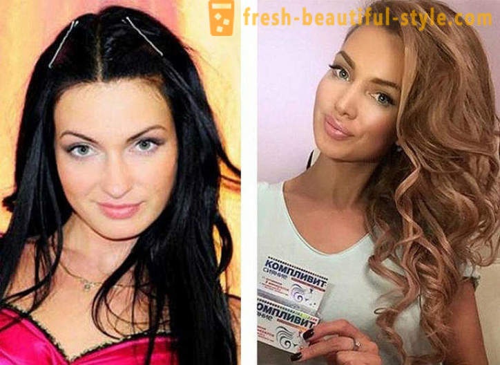 10 руске лепотице пре и после пластике