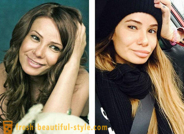 10 руске лепотице пре и после пластике