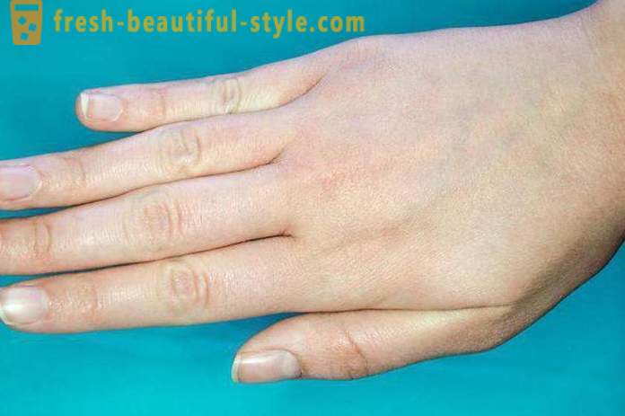 Перутава кожа на лицу и рукама: могући узроци и карактеристике бриге