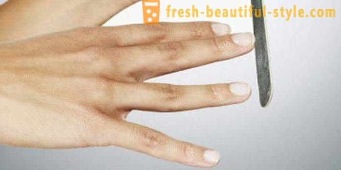 Беле мрље на ноктима прстију: узроцима и лечењу