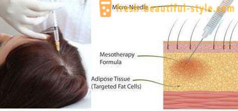 Мезотерапија за косу: Шминка алата и контраиндикација